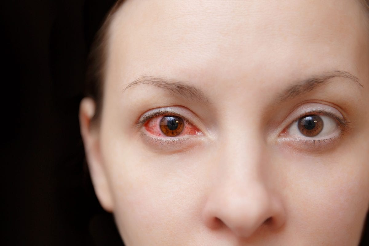 Edmonton Emergency Eyes